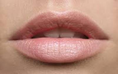 Relleno de labios, surcos y pómulos