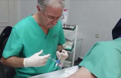 Esclerosis de Varices en albacete