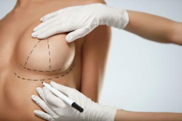 Elevación de senos o Mastopexia