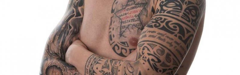 Eliminación de tatuajes con Láser